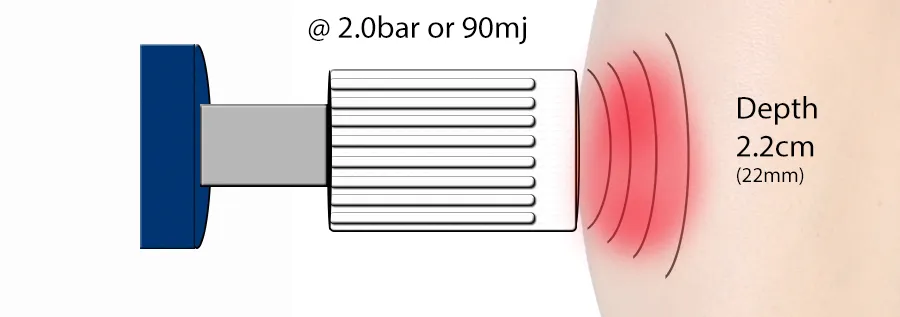 Shockwave 2 bar