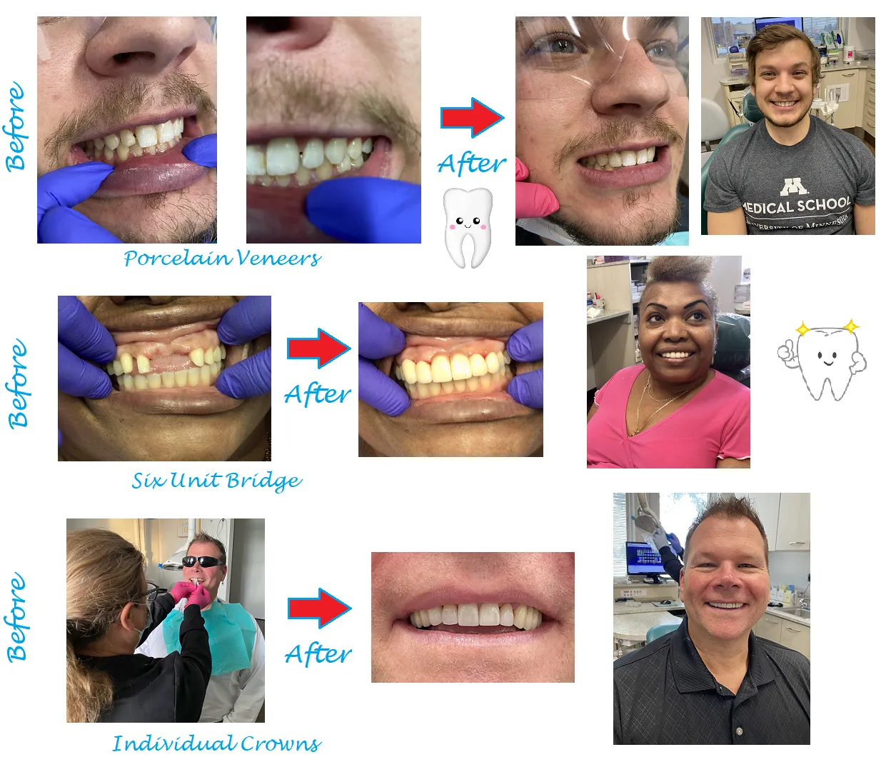 Before & After