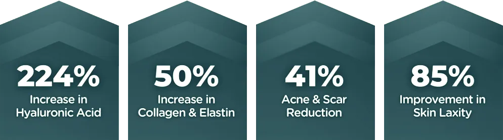 rf microneedling treatment with exion in winter park, florida