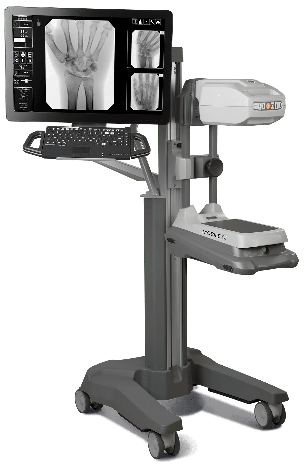 Orthoscan Mobile DI