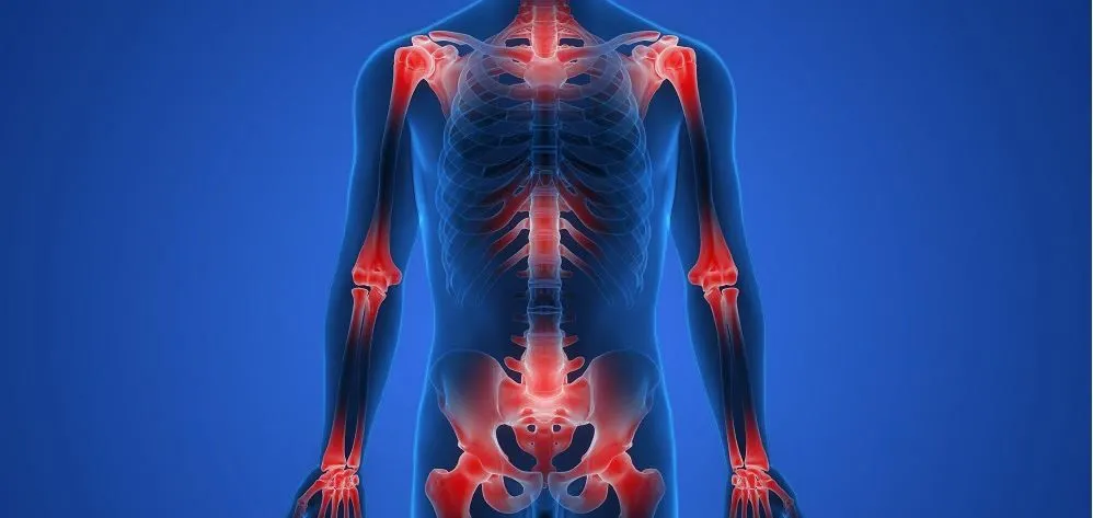 Human body xray illustration