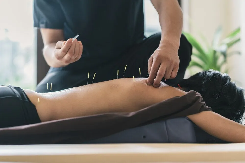 Acupuncturist is doing some acupuncture treatment in plantation to the patient