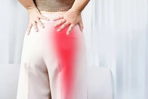 Sciatica-treatment