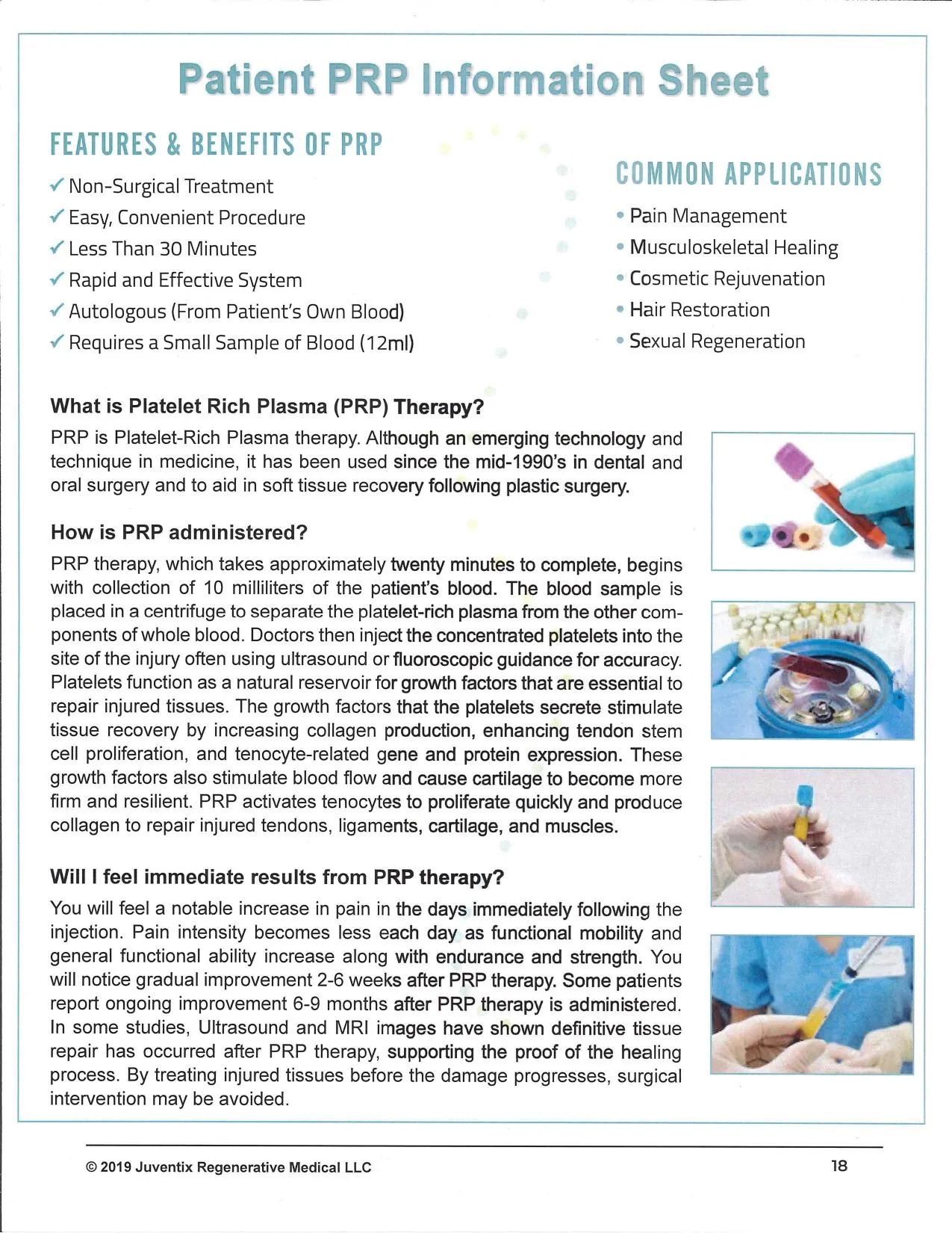 Patient PRP information sheet