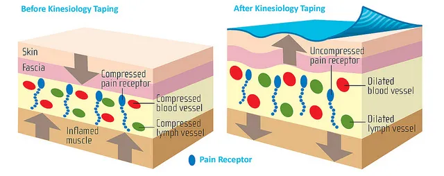 Kinesio Taping Overview