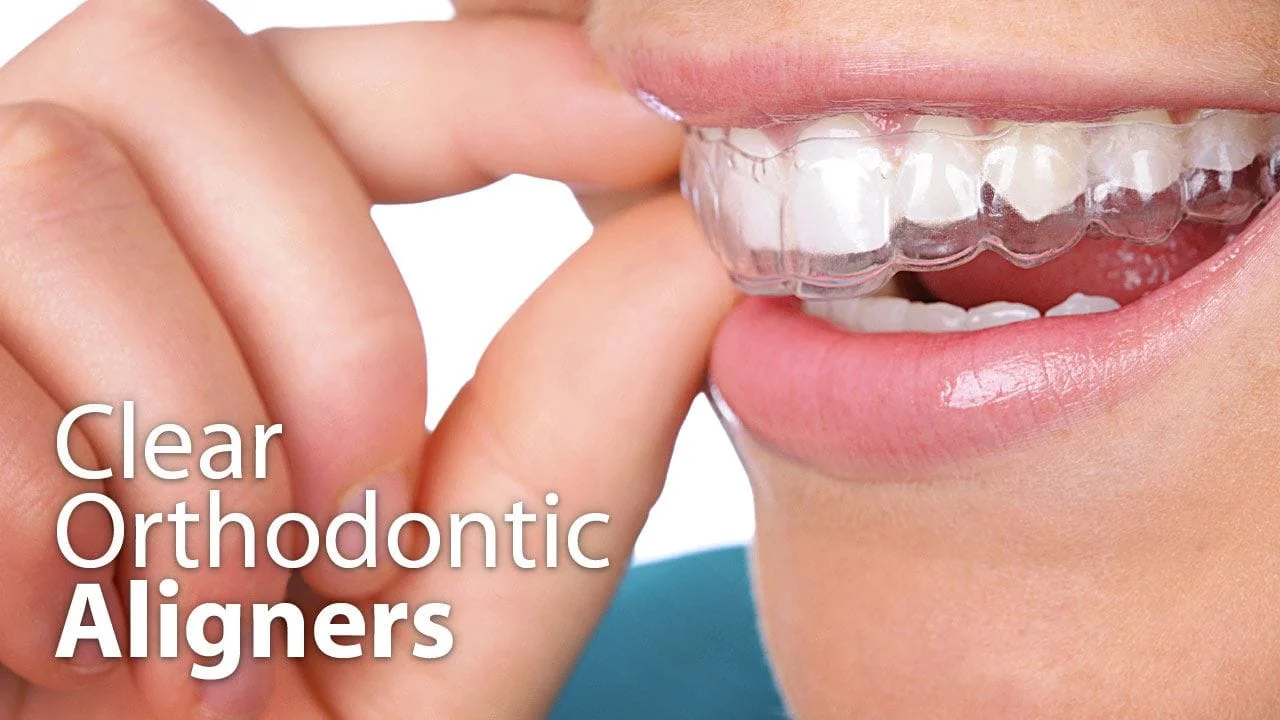 Clear Aligner Therapy