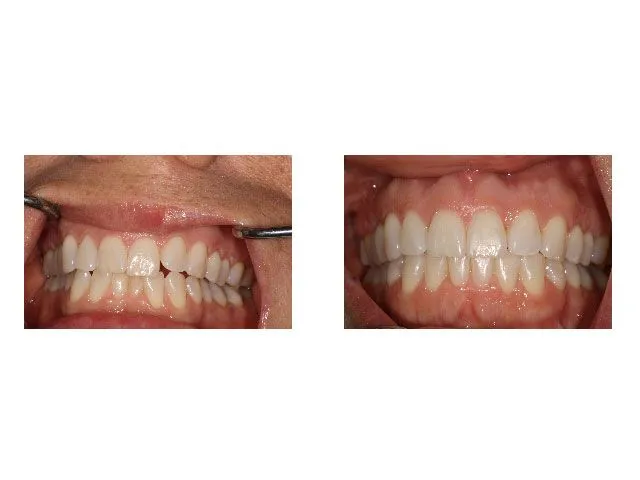 Before and After Treatment