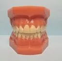 Invisalign Des Plaines IL