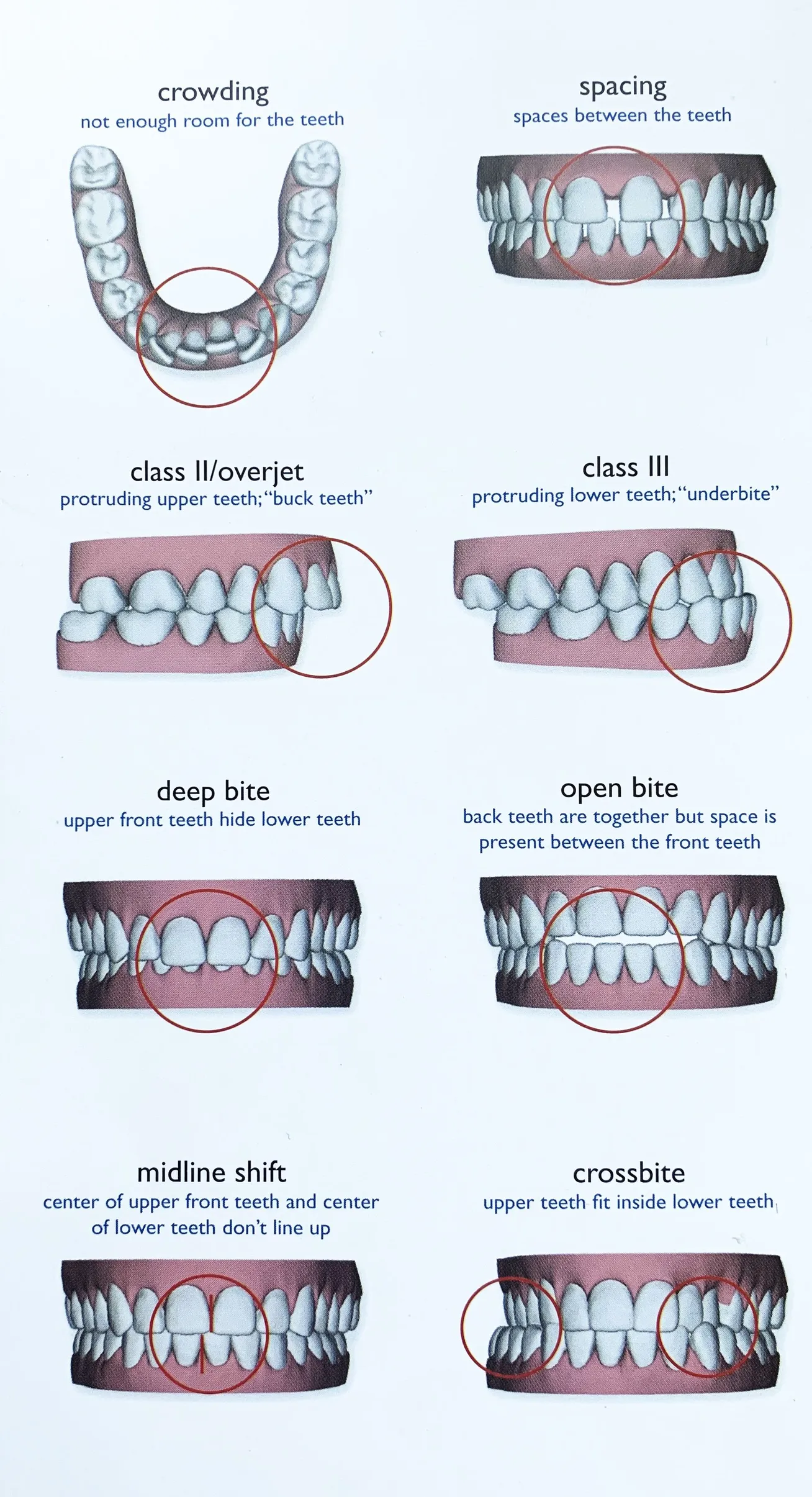 Invisalign in Reston, VA