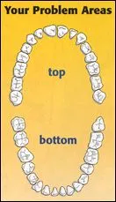 periodontal-disease-2