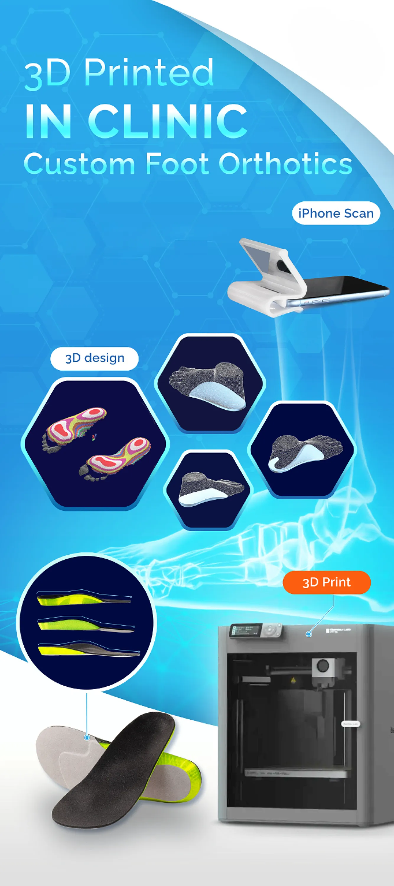 3d Printed orthotics
