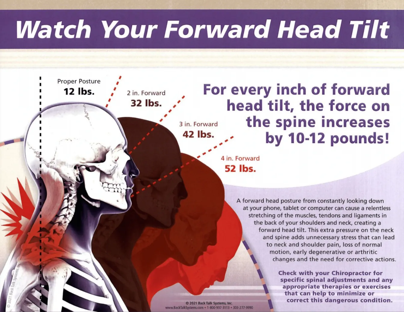 Forward Head Tilt Photo