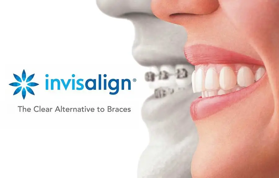 Invisalign