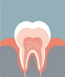 Fillings | Dentist in Interlochen, MI | Interlochen Family Dentistry 