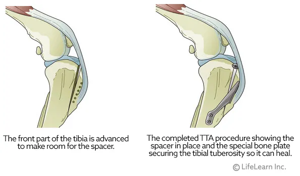 TTA Process 2