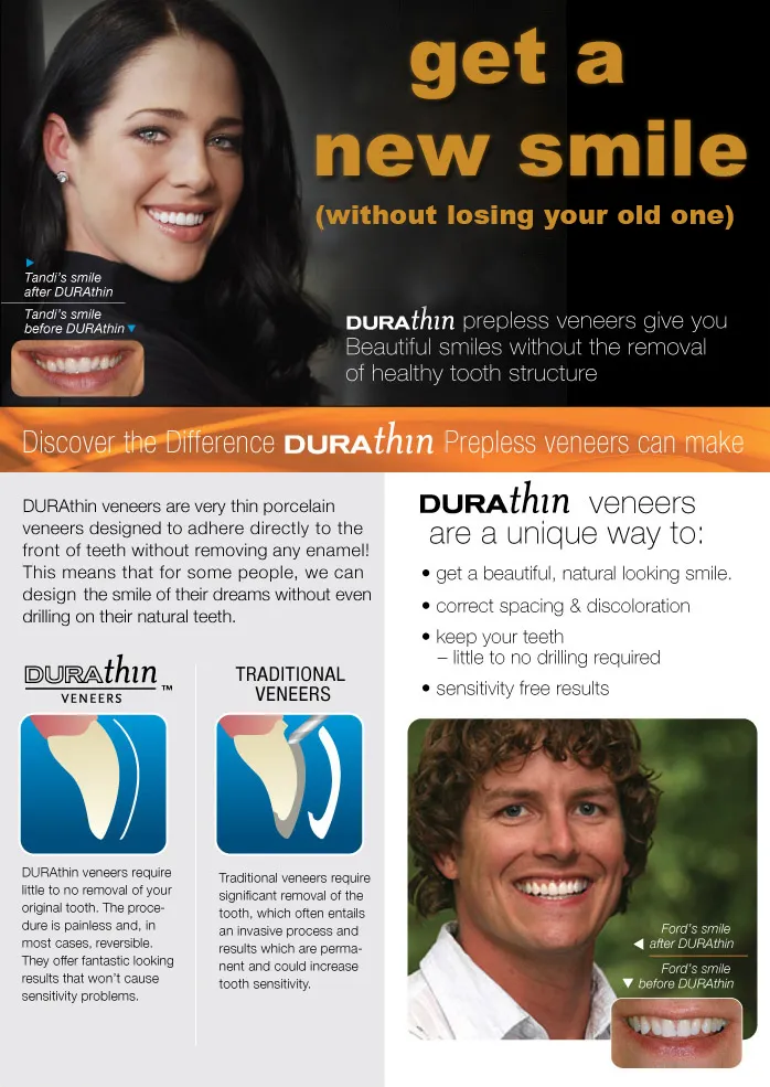 Durathin Veneers