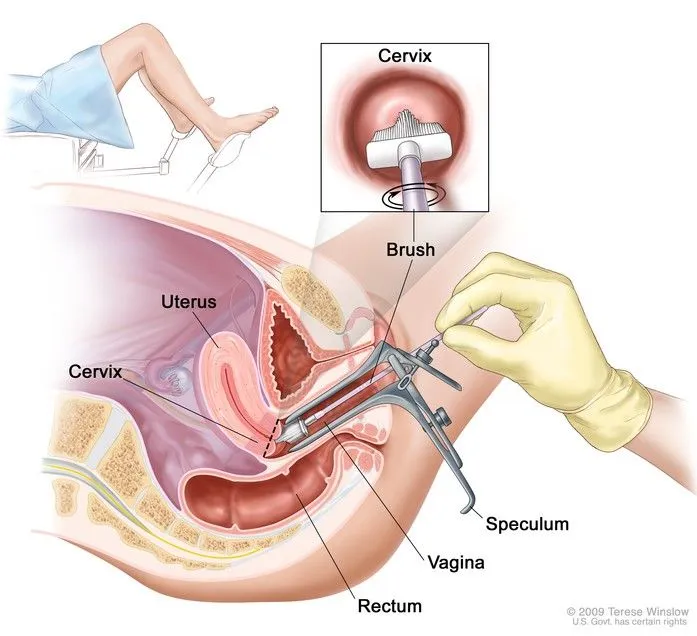 pap-test