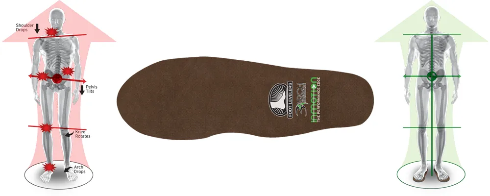 Custom Orthotics