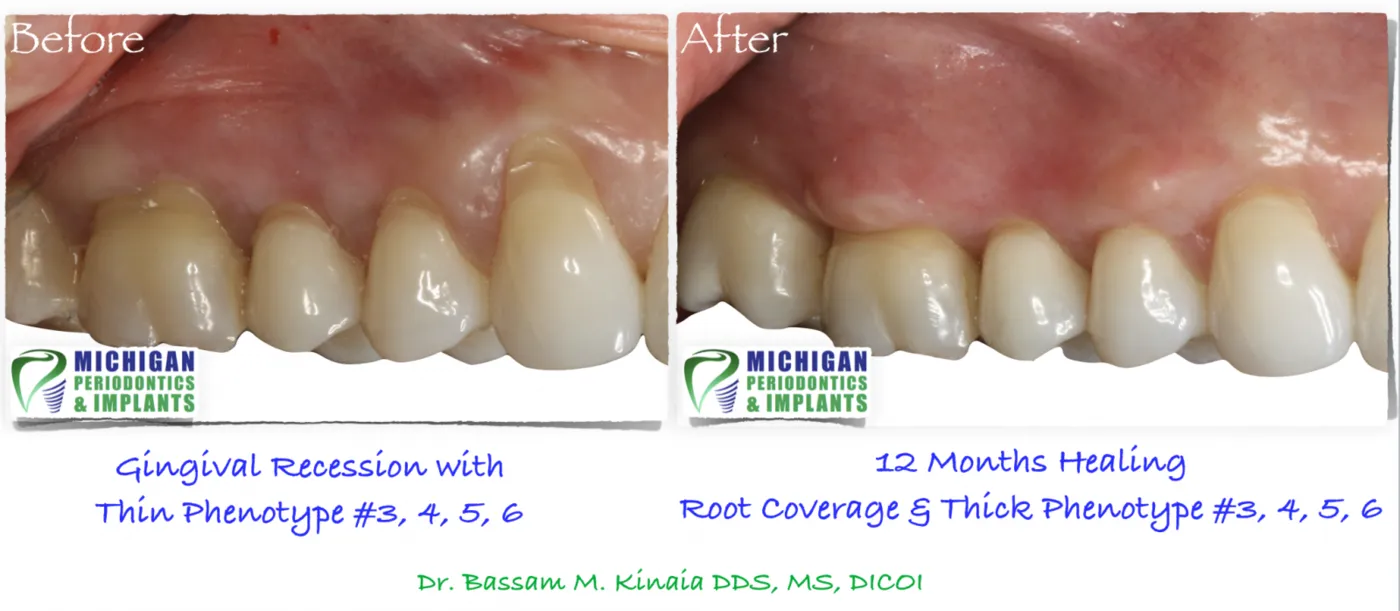 Periodontist rochester hills Michigan 