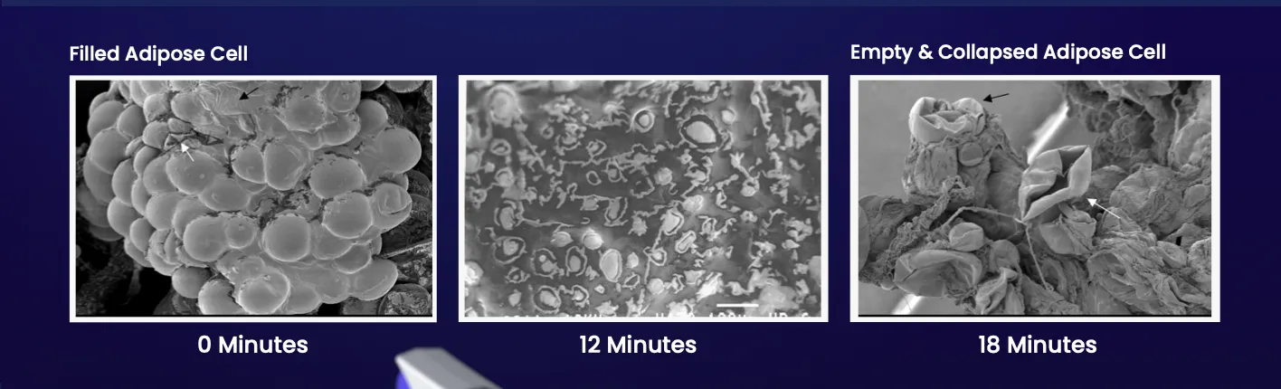 Emulsification of Fat Cells