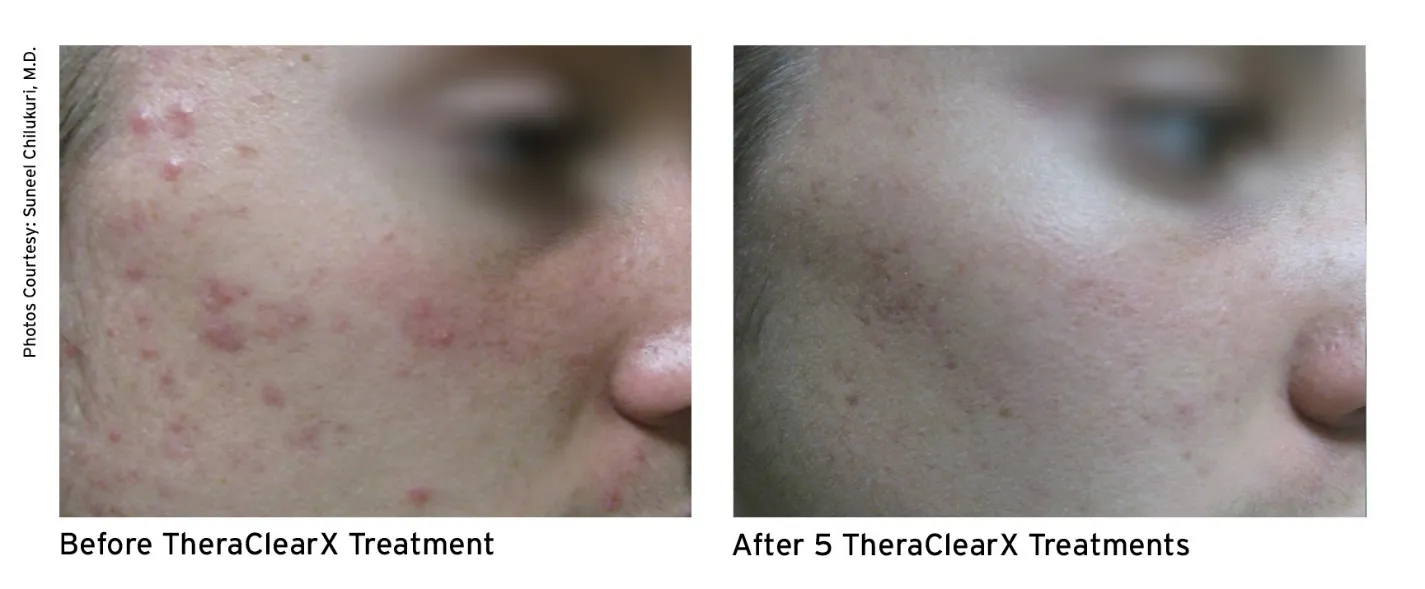 Before and after - Face 4