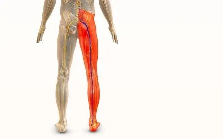 Sciatica-treatment