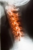 Introduction to Common Conditions Treated | Basalt, Aspen, Carbondale, Spine Spot Chiropractic
