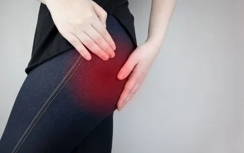 Sciatica