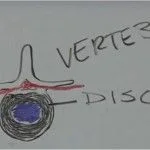 Invertebral Disc