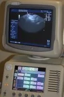 HAL on GE LOQIC 7 Ultrasound Machine