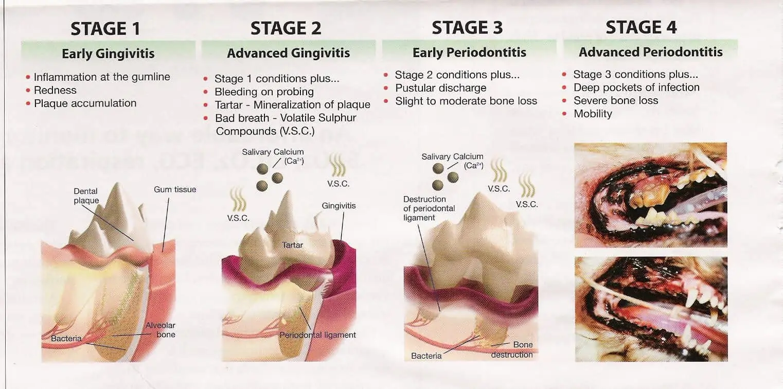 Stages of Oral Disease