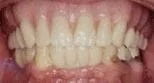 implants roselle dentist