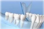 Caledonia Dental Implants