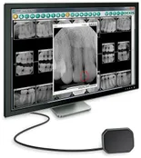 dexis digital xrays