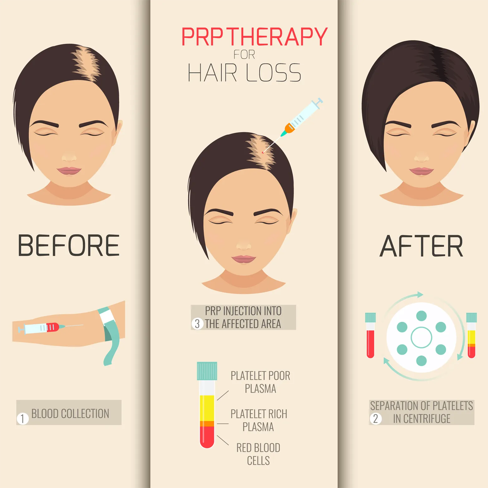 Platelet Rich Plasma Therapy