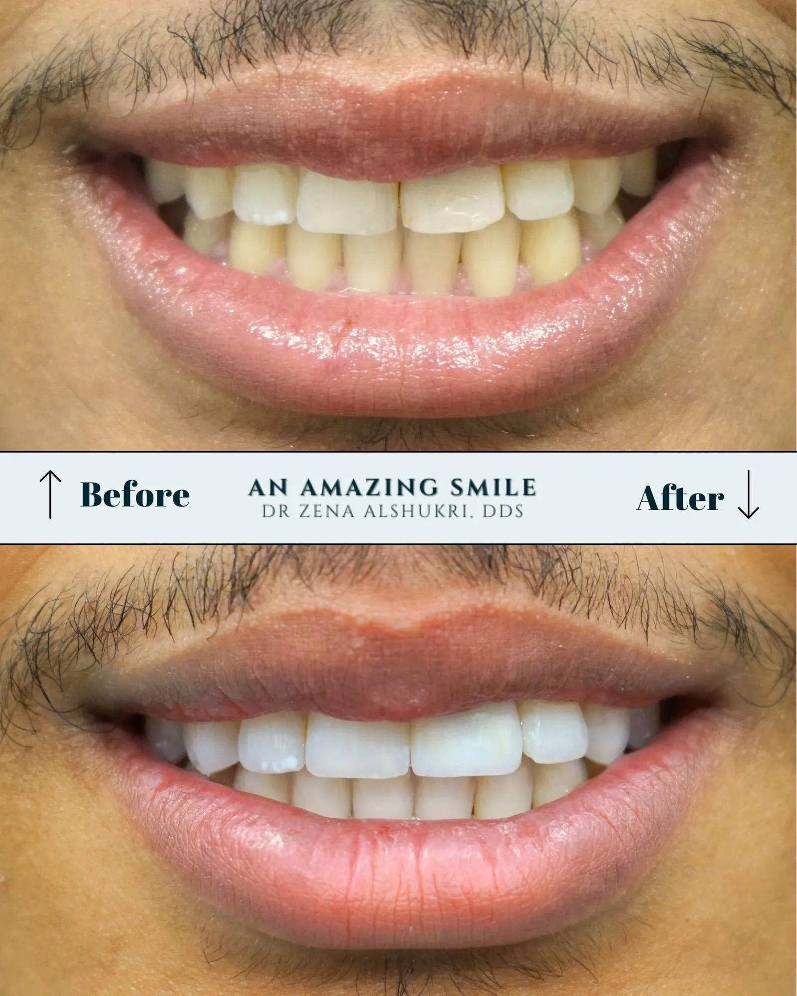 An Amazing Smile | Home in Tempe