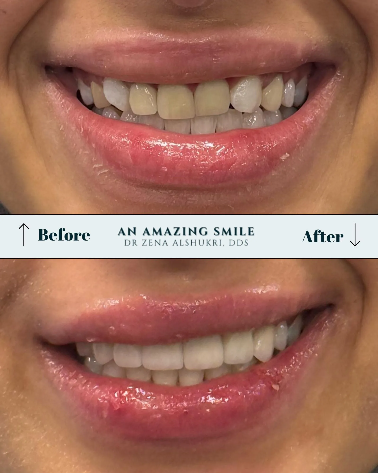 An Amazing Smile | Home in Tempe