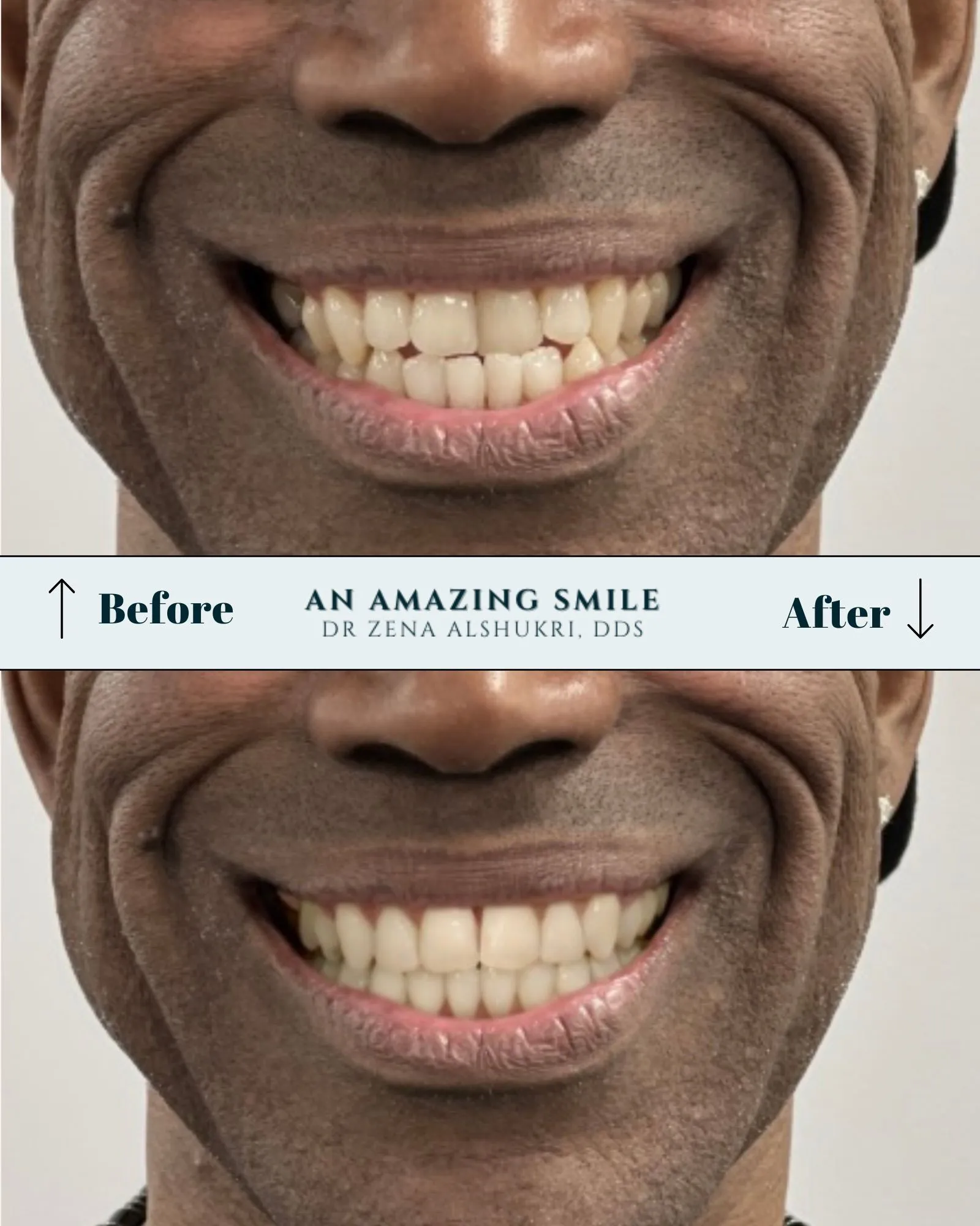 An Amazing Smile | Home in Tempe