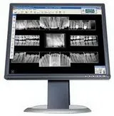 Digital radiograph