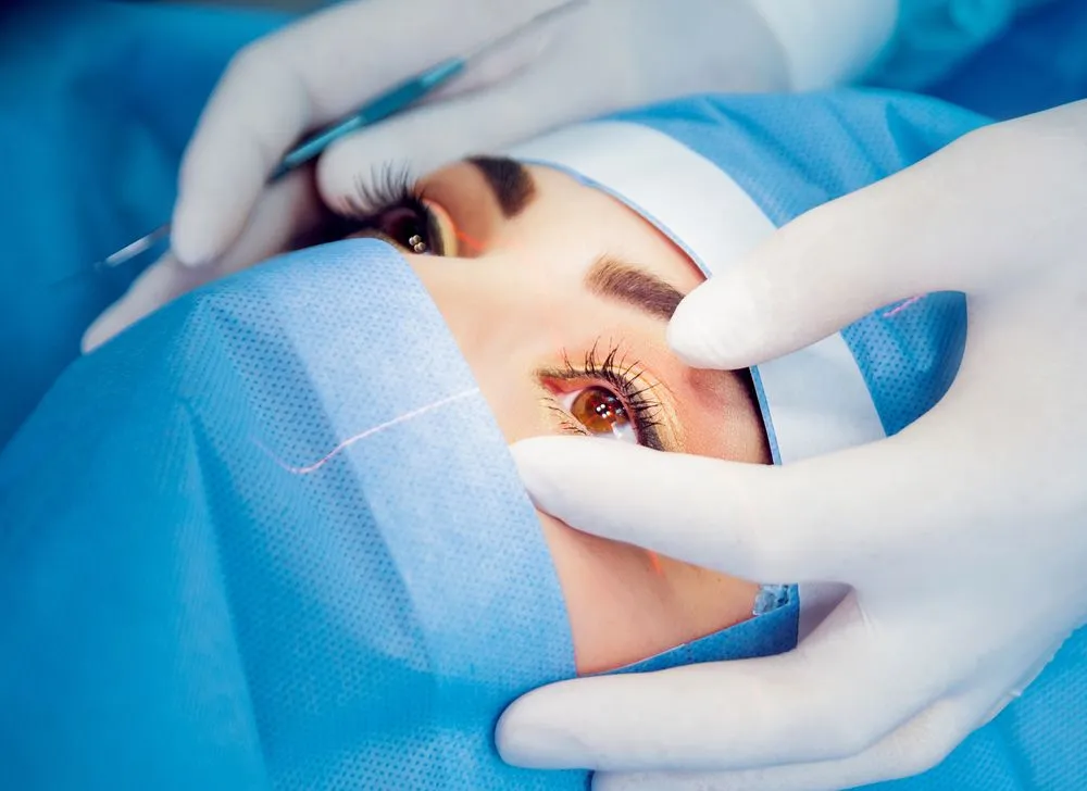 LASIK FAQs