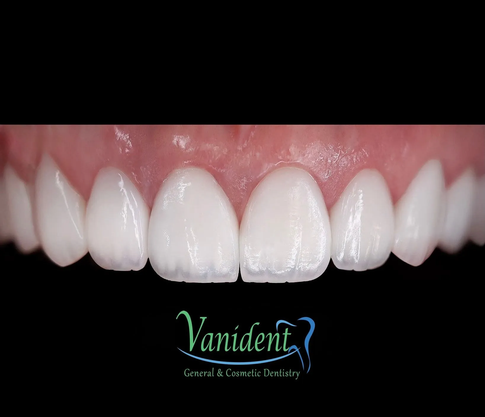 Enhances your smile with cosmetic dentistry 