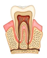 Root Canals | Dentist in Worcester, MA | Dentistry by Dr. Nita Gampa