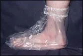 Directions for applying Foot and Ankle and Foot to Thigh Protectors Foot and Ankle