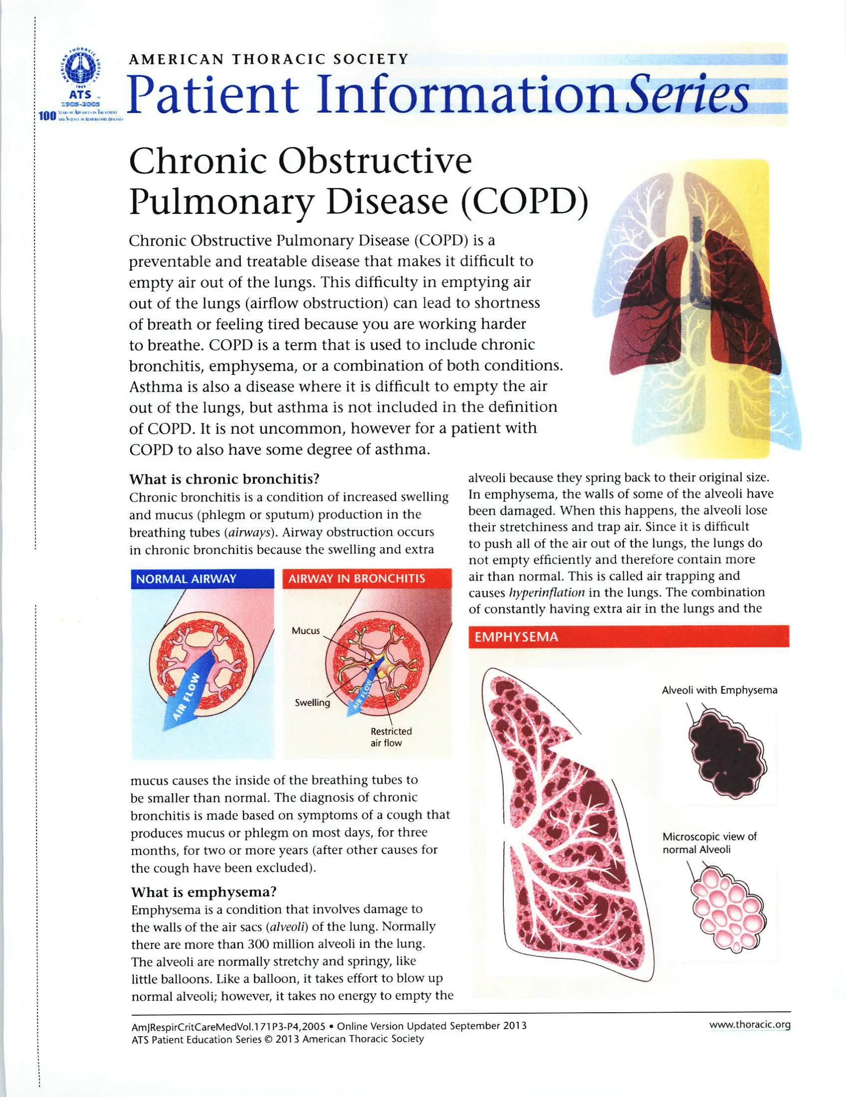 copd-info-1