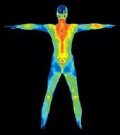 thermography