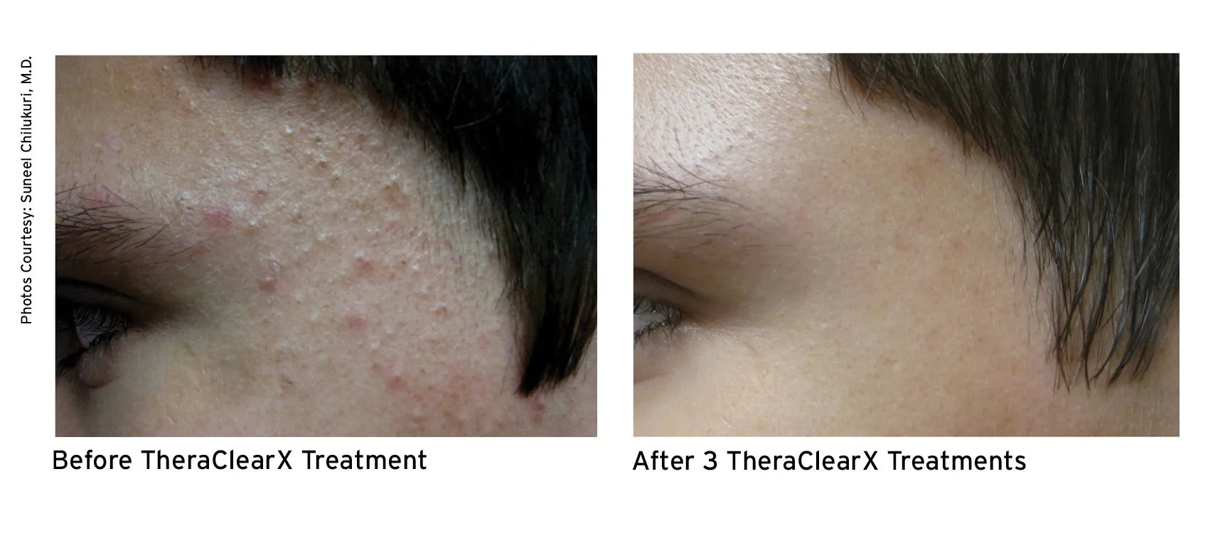 Before and after - Temple