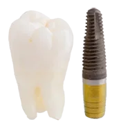 tooth_implant