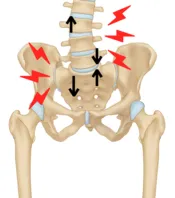 Pain from an SI sprain