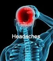 headaches-huntsville-al