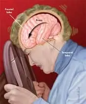 brain injury_1.jpg